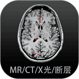 【流言版】林加德：在韩国活吃章鱼一开始怕后来觉得味道不错 离开曼联哭了